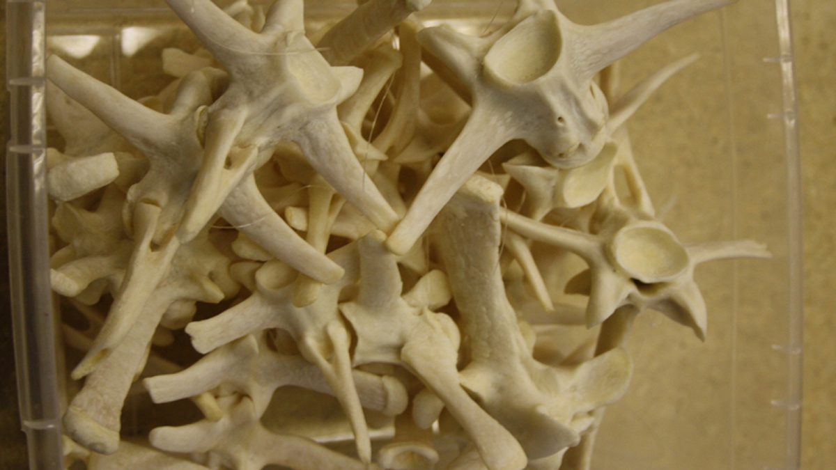 Multiple vertebrae that are very clean after degreasing