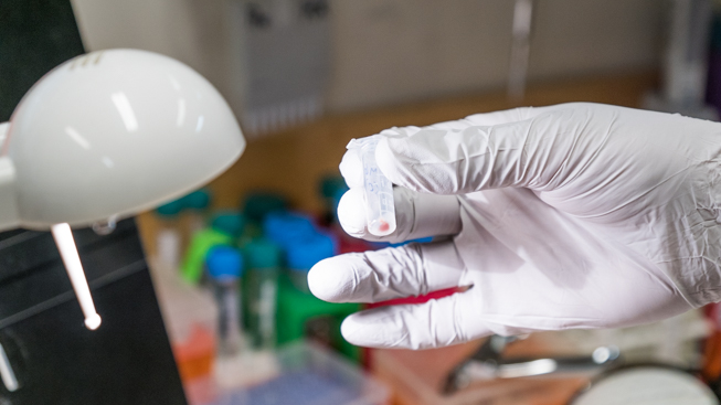 A close-up photo of one of the blue whale tissue samples used for DNA extraction. Photo by Connor McDowell