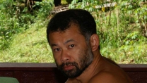 A bearded Dr. Burton Lim