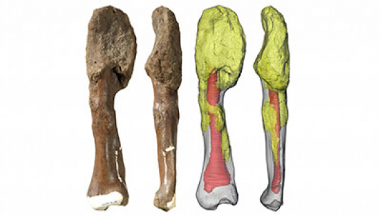 Healthy dinosaur bones compared to dinosaur bones with tumours.